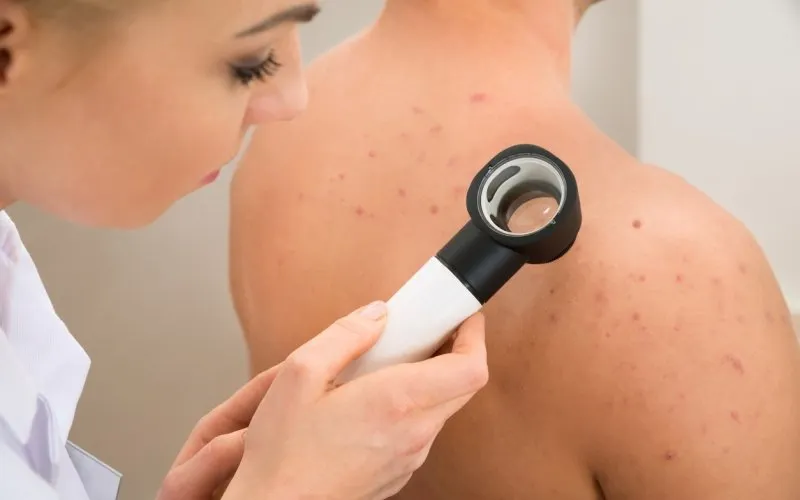 Consulta dermatologica