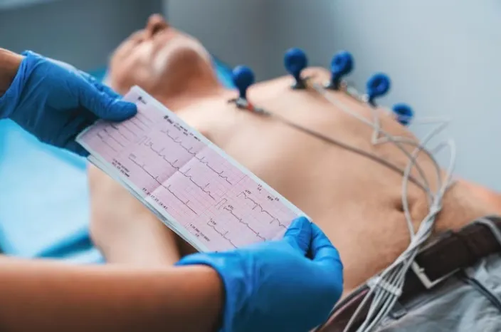 Electrocardiograma